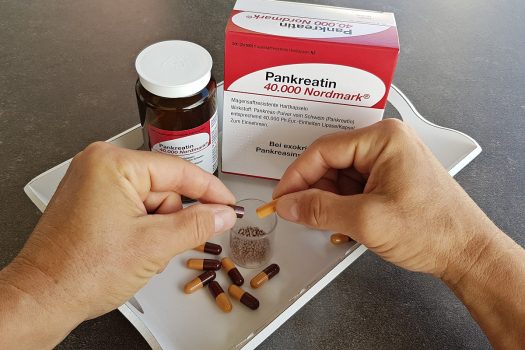 Essen nach Magenentfernung: Besser verdauen mit Pankreasenzymen! Weitere Tipps.